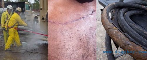 �߉���ϴ�C(j��)��ʹ���L(f��ng)�U(xi��n)